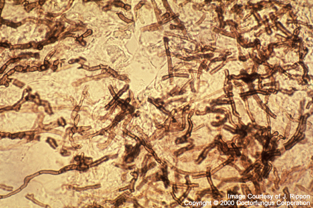 scytalidium
