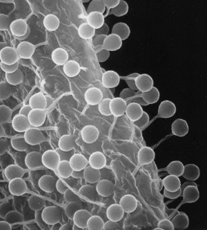 ceratiomyxa
