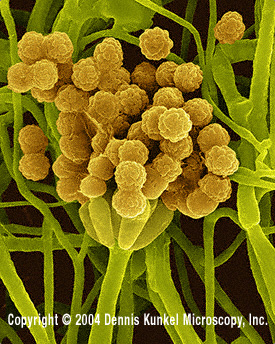 memnoniella