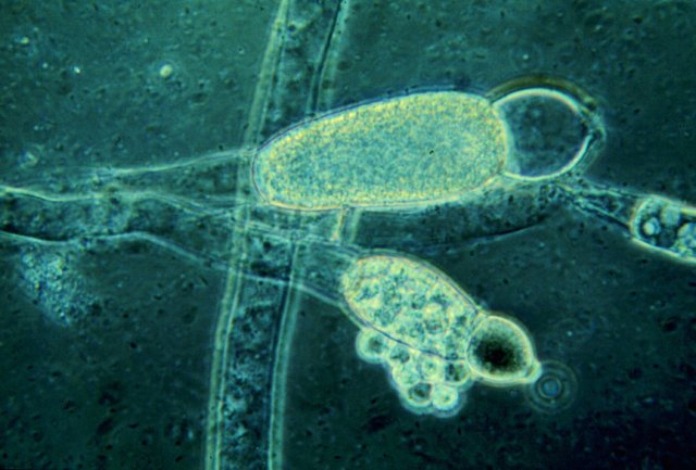 allomyces gametangia