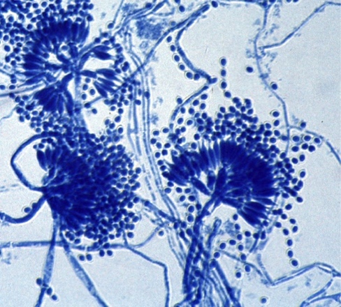 conidiophores of Talaromyces marneffei, a pathogenic fungus